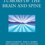خرید و دانلود نسخه کامل کتاب Demonte Tumors of the Brain and Spine-MD Anderson Cancer Care Series