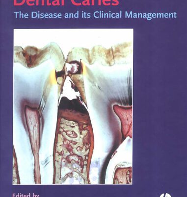 خرید و دانلود نسخه کامل کتاب Dental Caries: The Disease and Its Clinical Management