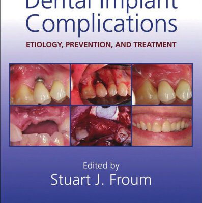 خرید و دانلود نسخه کامل کتاب Dental Implant Complications: Etiology, Prevention, and Treatment