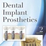 خرید و دانلود نسخه کامل کتاب Dental implant prosthetics