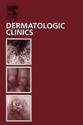 خرید و دانلود نسخه کامل کتاب Dermatologic Clinics (Infectious Diseases, Volume 21, Number 2, April 2003)_68b99f2549b28.jpeg خرید و دانلود نسخه کامل کتاب Dermatologic Clinics (Infectious Diseases, Volume 21, Number 2, April 2003)
