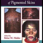 خرید و دانلود نسخه کامل کتاب Dermatology and Dermatological Therapy of Pigmented Skins