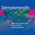 خرید و دانلود نسخه کامل کتاب Dermatomyositis: Advances in Recognition, Understanding and Management