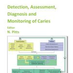 خرید و دانلود نسخه کامل کتاب Detection, Assessment, Diagnosis and Monitoring of Caries (Monographs in Oral Science Vol 21)