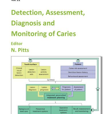 خرید و دانلود نسخه کامل کتاب Detection, Assessment, Diagnosis and Monitoring of Caries (Monographs in Oral Science Vol 21)