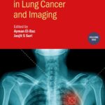خرید و دانلود نسخه کامل کتاب Detection Systems in Lung Cancer and Imaging