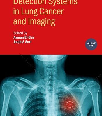 خرید و دانلود نسخه کامل کتاب Detection Systems in Lung Cancer and Imaging