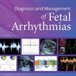 خرید و دانلود نسخه کامل کتاب Diagnosis and Management of Fetal Arrhythmias