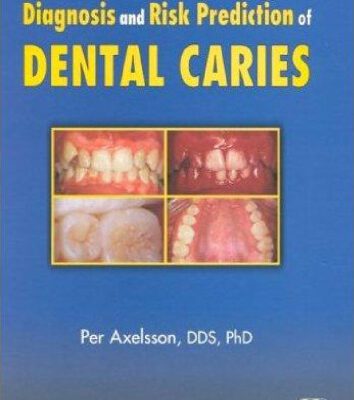 خرید و دانلود نسخه کامل کتاب Diagnosis and Risk Prediction of Dental Caries, Volume 2