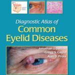 خرید و دانلود نسخه کامل کتاب Diagnostic Atlas of Common Eyelid Diseases