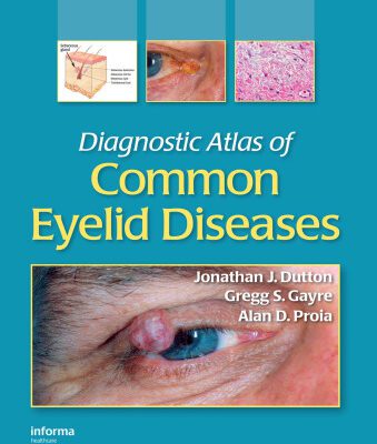خرید و دانلود نسخه کامل کتاب Diagnostic Atlas of Common Eyelid Diseases
