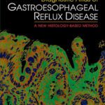 خرید و دانلود نسخه کامل کتاب Diagnostic Atlas of Gastroesophageal Reflux Disease