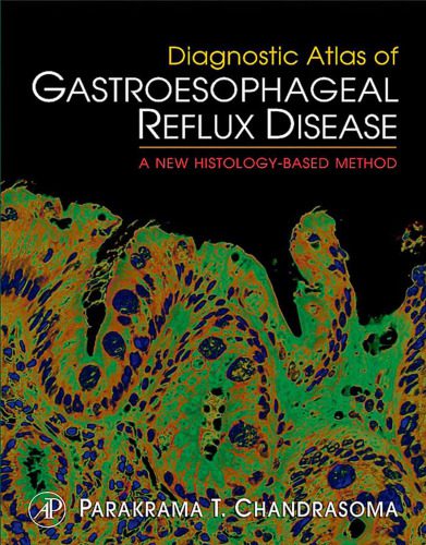 خرید و دانلود نسخه کامل کتاب Diagnostic Atlas of Gastroesophageal Reflux Disease_68b9b086e973f.jpeg خرید و دانلود نسخه کامل کتاب Diagnostic Atlas of Gastroesophageal Reflux Disease