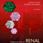 خرید و دانلود نسخه کامل کتاب Diagnostic Atlas of Renal Pathology
