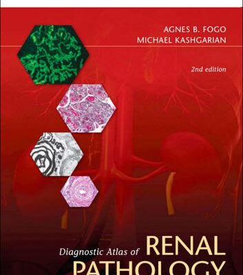 خرید و دانلود نسخه کامل کتاب Diagnostic Atlas of Renal Pathology