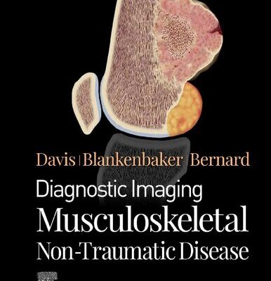 خرید و دانلود نسخه کامل کتاب Diagnostic Imaging: Musculoskeletal Non-Traumatic Disease