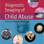 خرید و دانلود نسخه کامل کتاب Diagnostic Imaging of Child Abuse 3rd Edition