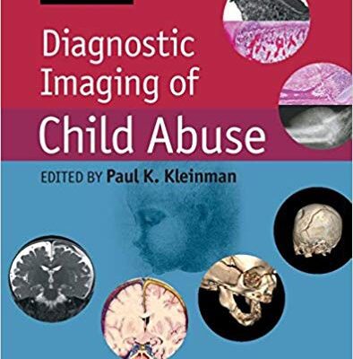 خرید و دانلود نسخه کامل کتاب Diagnostic Imaging of Child Abuse 3rd Edition