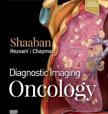 خرید و دانلود نسخه کامل کتاب Diagnostic Imaging: Oncology, 2e (2020)