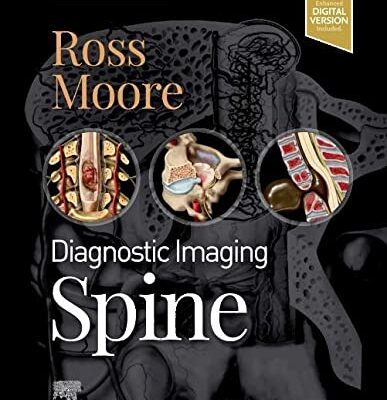 خرید و دانلود نسخه کامل کتاب Diagnostic Imaging: Spine