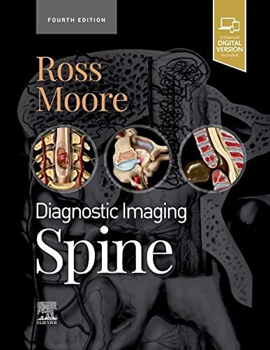 خرید و دانلود نسخه کامل کتاب Diagnostic Imaging: Spine_68b6220a0fbd4.jpeg خرید و دانلود نسخه کامل کتاب Diagnostic Imaging: Spine