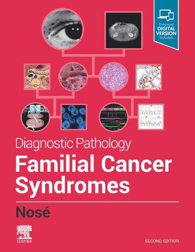 خرید و دانلود نسخه کامل کتاب Diagnostic Pathology: Familial Cancer Syndromes_68b623e84a648.jpeg خرید و دانلود نسخه کامل کتاب Diagnostic Pathology: Familial Cancer Syndromes