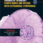 خرید و دانلود نسخه کامل کتاب Diagnostic Pathology: Lymph Nodes and Spleen with Extranodal Lymphomas: Published by Amirsys