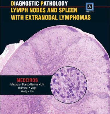 خرید و دانلود نسخه کامل کتاب Diagnostic Pathology: Lymph Nodes and Spleen with Extranodal Lymphomas: Published by Amirsys