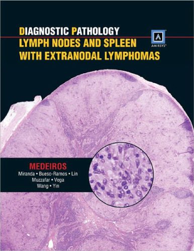 خرید و دانلود نسخه کامل کتاب Diagnostic Pathology: Lymph Nodes and Spleen with Extranodal Lymphomas: Published by Amirsys_68b6601a6723c.jpeg خرید و دانلود نسخه کامل کتاب Diagnostic Pathology: Lymph Nodes and Spleen with Extranodal Lymphomas: Published by Amirsys