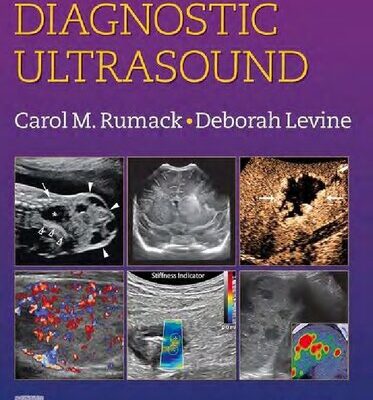 خرید و دانلود نسخه کامل کتاب Diagnostic Ultrasound, 2-Volume Set