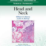 خرید و دانلود نسخه کامل کتاب Differential Diagnoses in Surgical Pathology: Head and Neck