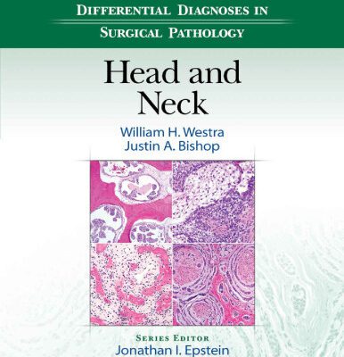 خرید و دانلود نسخه کامل کتاب Differential Diagnoses in Surgical Pathology: Head and Neck