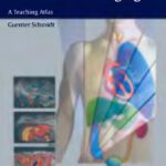 خرید و دانلود نسخه کامل کتاب Differential Diagnosis in Ultrasound Imaging: A Teaching Atlas