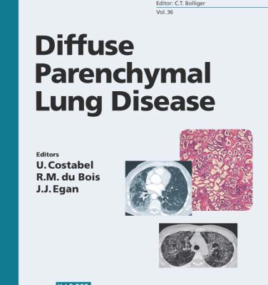 خرید و دانلود نسخه کامل کتاب Diffuse Parenchymal Lung Disease (Progress in Respiratory Research)
