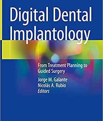 خرید و دانلود نسخه کامل کتاب Digital Dental Implantology: From Treatment Planning to Guided Surgery – Orginal Pdf