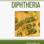 خرید و دانلود نسخه کامل کتاب Diphtheria (Deadly Diseases and Epidemics)
