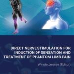 خرید و دانلود نسخه کامل کتاب Direct Nerve Stimulation for Induction of Sensation and Treatment of Phantom Limb Pain