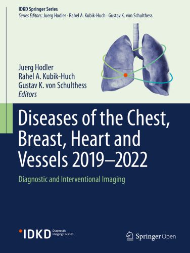 خرید و دانلود نسخه کامل کتاب Diseases of the Chest, Breast, Heart and Vessels 2019-2022: Diagnostic and Interventional Imaging_68b9f50280c19.jpeg خرید و دانلود نسخه کامل کتاب Diseases of the Chest, Breast, Heart and Vessels 2019-2022: Diagnostic and Interventional Imaging