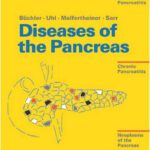 خرید و دانلود نسخه کامل کتاب Diseases of the Pancreas: Acute Pancreatitis, Chronic Pancreatitis, Tumours of the Pancreas
