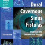 خرید و دانلود نسخه کامل کتاب Dural Cavernous Sinus Fistulas: Diagnosis and Endovascular Therapy (Medical Radiology   Diagnostic Imaging)