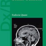 خرید و دانلود نسخه کامل کتاب Dx Rx: Brain Tumors (Dx Rx Neurology Series)