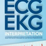 خرید و دانلود نسخه کامل کتاب ECG / EKG Interpretation: A Systematic Approach to Read a 12-Lead ECG