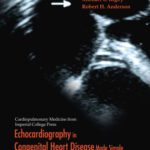 خرید و دانلود نسخه کامل کتاب Echocardiography in Congenital Heart Disease Made Simple