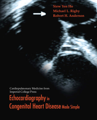 خرید و دانلود نسخه کامل کتاب Echocardiography in Congenital Heart Disease Made Simple