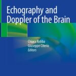 خرید و دانلود نسخه کامل کتاب Echography and Doppler of the Brain