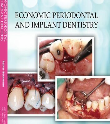 خرید و دانلود نسخه کامل کتاب Economic Periodontal and Implant Dentistry