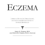 خرید و دانلود نسخه کامل کتاب Eczema – A Medical Dictionary, Bibliography, and Annotated Research Guide to Internet References
