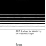 خرید و دانلود نسخه کامل کتاب EEG analysis of monitoring of anaestetics depth