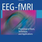 خرید و دانلود نسخه کامل کتاب EEG – fMRI: Physiological Basis, Technique, and Applications