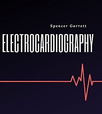 خرید و دانلود نسخه کامل کتاب electrocardiography : Basics of electrocardiography (FRESH MAN) Kindle Edition –  +  PDF